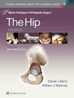 Majstrovské techniky v ortopedickej chirurgii: Bedrový kĺb: lekárske metódy v ortopédii - Master Techniques in Orthopaedic Surgery: The Hip
