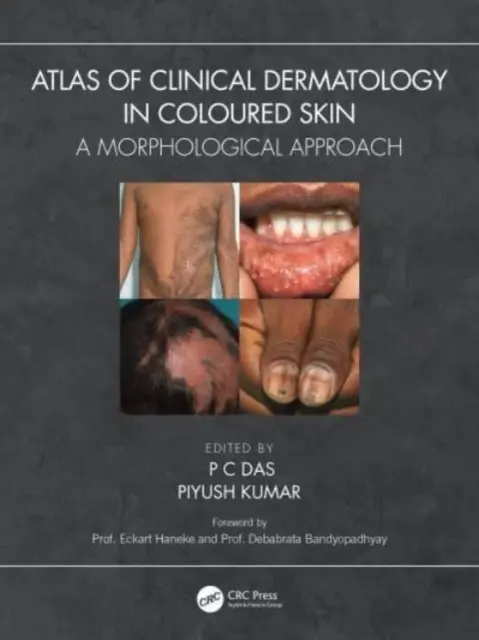 Atlas klinickej dermatológie pri farebnej pokožke: A Morphological Approach (Morfologický prístup) - Atlas of Clinical Dermatology in Coloured Skin: A Morphological Approach