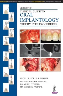 Klinický sprievodca ústnou implantológiou: Knižný sprievodca implantológiou: postupy krok za krokom - Clinical Guide to Oral Implantology: Step by Step Procedures