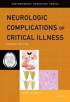 Neurologické komplikácie kritických ochorení - Neurologic Complications of Critical Illness