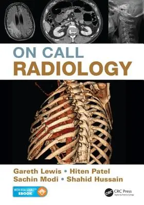 Rádiológia na zavolanie - On Call Radiology