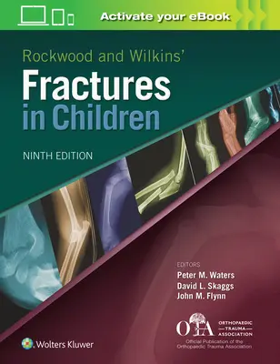 Rockwoodove a Wilkinsove zlomeniny u detí - Rockwood and Wilkins Fractures in Children