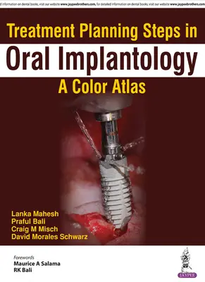 Kroky plánovania liečby v ústnej implantológii: Farebný atlas - Treatment Planning Steps in Oral Implantology: A Color Atlas