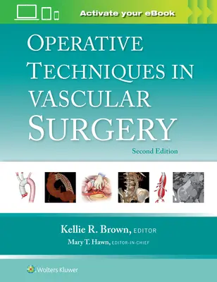 Operačné techniky v cievnej chirurgii - Operative Techniques in Vascular Surgery