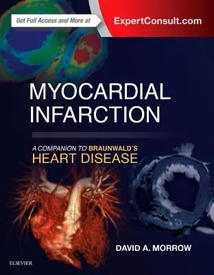Infarkt myokardu: A Companion to Braunwald's Heart Disease - Myocardial Infarction: A Companion to Braunwald's Heart Disease