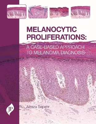 Melanocytové proliferácie - prístup k diagnostike melanómu na základe prípadu - Melanocytic Proliferations - A Case-Based Approach to Melanoma Diagnosis