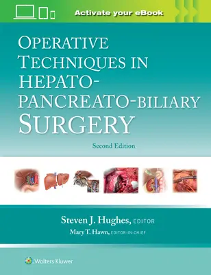 Operačné techniky v hepatopankreatickej a biliárnej chirurgii - Operative Techniques in Hepato-Pancreato-Biliary Surgery