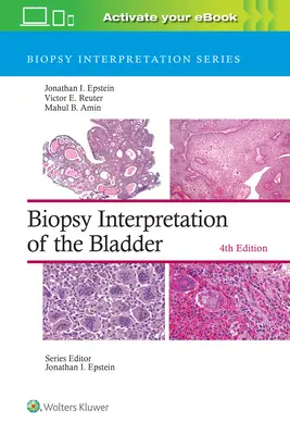 Interpretácia biopsie močového mechúra - Biopsy Interpretation of the Bladder
