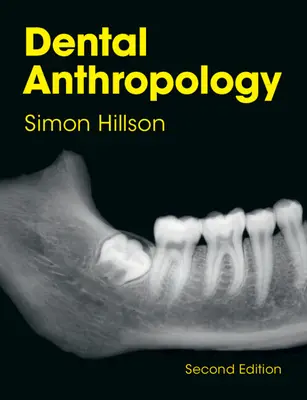 Dentálna antropológia (Hillson Simon (University College London)) - Dental Anthropology (Hillson Simon (University College London))