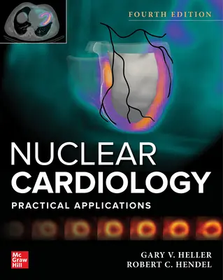 Nukleárna kardiológia: Praktické aplikácie, štvrté vydanie - Nuclear Cardiology: Practical Applications, Fourth Edition