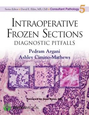 Intraoperačné zmrazené rezy: Diagnostické úskalia - Intraoperative Frozen Sections: Diagnostic Pitfalls