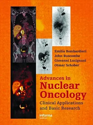 Advances in Nuclear Oncology:: Diagnostika a terapia: nové poznatky v oblasti onkologickej diagnostiky a terapie - Advances in Nuclear Oncology:: Diagnosis and Therapy