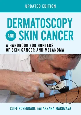 Dermatoskopia a rakovina kože, aktualizované vydanie - Príručka pre lovcov rakoviny kože a melanómu - Dermatoscopy and Skin Cancer, updated edition - A handbook for hunters of skin cancer and melanoma