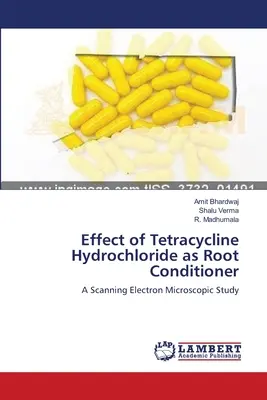 Účinok tetracyklín hydrochloridu ako koreňového kondicionéru - Effect of Tetracycline Hydrochloride as Root Conditioner