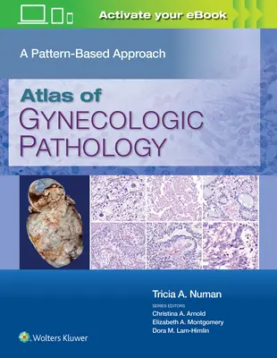 Atlas gynekologickej patológie: A Pattern-Based Approach (Prístup založený na vzoroch) - Atlas of Gynecologic Pathology: A Pattern-Based Approach