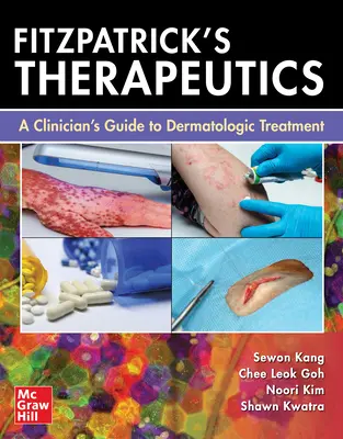 Fitzpatrickova terapia: A Clinician's Guide to Dermatologic Treatment - Fitzpatrick's Therapeutics: A Clinician's Guide to Dermatologic Treatment