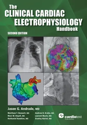 Príručka klinickej kardiologickej elektrofyziológie, druhé vydanie - The Clinical Cardiac Electrophysiology Handbook, Second Edition