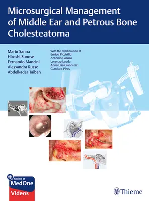 Mikrochirurgická liečba cholesteatómu stredného ucha a drobných kostí - Microsurgical Management of Middle Ear and Petrous Bone Cholesteatoma