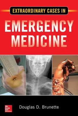 Mimoriadne prípady v urgentnej medicíne - Extraordinary Cases in Emergency Medicine