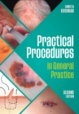 Praktické postupy vo všeobecnej praxi, druhé vydanie (Kochhar Suneeta (GP in East Sussex)) - Practical Procedures in General Practice, second edition (Kochhar Suneeta (GP in East Sussex))