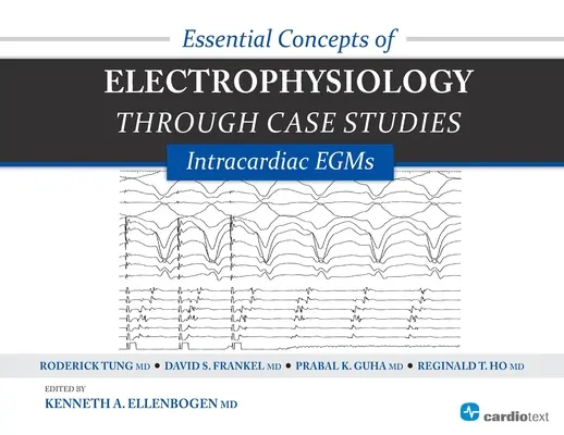 Základné pojmy elektrofyziológie prostredníctvom prípadových štúdií: Intrakardiálne EGM: Intrakardiálne EGMs - Essential Concepts of Electrophysiology Through Case Studies: Intracardiac EGMs: Intracardiac EGMs