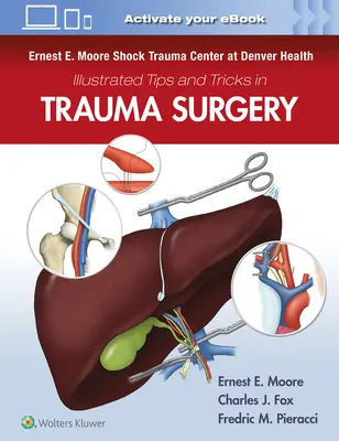 Ernest E. Moore Shock Trauma Center at Denver Health Ilustrované tipy a triky v úrazovej chirurgii - Ernest E. Moore Shock Trauma Center at Denver Health Illustrated Tips and Tricks in Trauma Surgery
