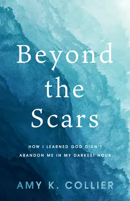 Za hranicami jaziev: Ako som sa naučil, že ma Boh neopustil v mojej najtemnejšej hodine - Beyond the Scars: How I Learned God Didn't Abandon Me in My Darkest Hour