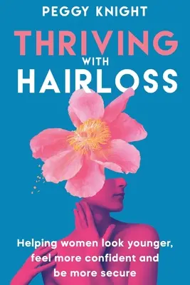 Ako sa darí vypadávaniu vlasov: Pomôcť ženám vyzerať mladšie, cítiť sa sebavedomejšie a byť istejšie - Thriving With Hairloss: Helping Women Look Younger, Feel More Confident and Be More Secure