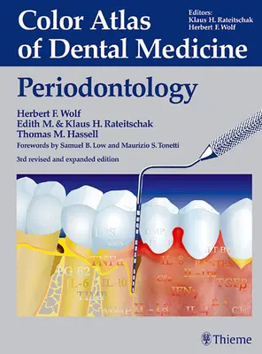 Farebný atlas zubného lekárstva: Periodontológia - Color Atlas of Dental Medicine: Periodontology