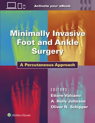 Minimálne invazívna chirurgia nohy a členka: Perkutánny prístup - Minimally Invasive Foot and Ankle Surgery: A Percutaneous Approach