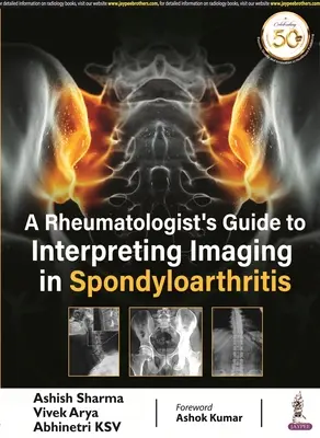 Príručka reumatológa k interpretácii zobrazovacích metód pri spondyloartritíde - Rheumatologist's Guide to Interpreting Imaging in Spondyloarthritis