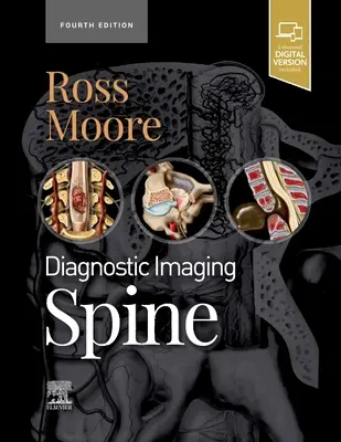 Diagnostické zobrazovanie: (Ross Jeffrey S. (profesor rádiológie Mayo Clinic College Rochester Minnesota)) - Diagnostic Imaging: Spine (Ross Jeffrey S. (Professor of Radiology Mayo Clinic College Rochester Minnesota))