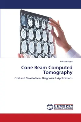 Počítačová tomografia s kužeľovým lúčom - Cone Beam Computed Tomography