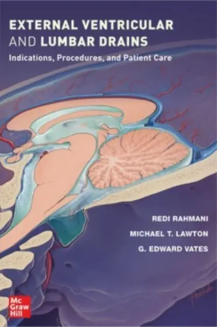 Vonkajšie komorové a bedrové drény: Indikácie, postupy a starostlivosť o pacienta - External Ventricular and Lumbar Drains: Indications, Procedures, and Patient Care
