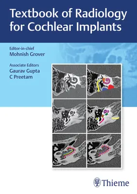 Učebnica rádiológie pre kochleárne implantáty - Textbook of Radiology for Cochlear Implants