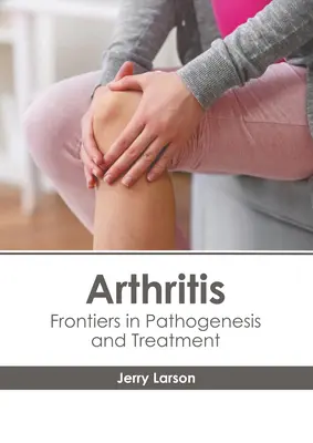 Artritída: Hranice patogenézy a liečby - Arthritis: Frontiers in Pathogenesis and Treatment