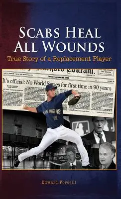 Chrasty zahoja všetky rany: Skutočný príbeh náhradného hráča - Scabs Heal All Wounds: True Story of a Replacement Player