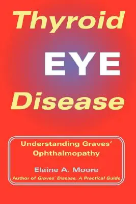 Očné ochorenie štítnej žľazy: Pochopenie Gravesovej oftalmopatie - Thyroid Eye Disease: Understanding Graves' Ophthalmopathy