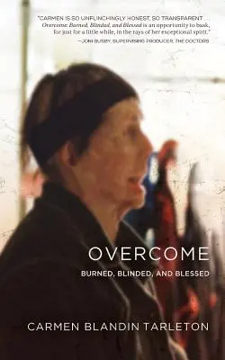 Prekonať: Popálený, oslepený a blahoslavený - Overcome: Burned, Blinded, and Blessed
