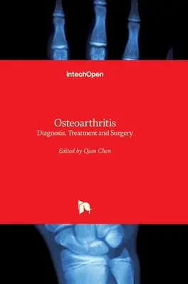 Osteoartróza: Diagnostika, liečba a chirurgia - Osteoarthritis: Diagnosis, Treatment and Surgery