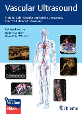 Ultrazvuk ciev: B-mód, farebný dopplerovský a duplexný ultrazvuk, ultrazvuk s kontrastným efektom - Vascular Ultrasound: B-Mode, Color Doppler and Duplex Ultrasound, Contrast-Enhanced Ultrasound