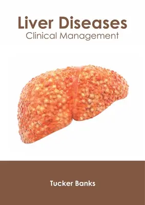 Choroby pečene: Klinický manažment - Liver Diseases: Clinical Management