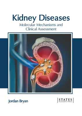 Choroby obličiek: Molekulárne mechanizmy a klinické hodnotenie - Kidney Diseases: Molecular Mechanisms and Clinical Assessment