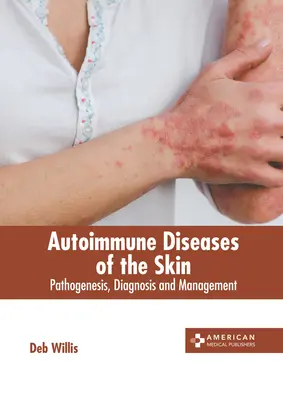 Autoimunitné ochorenia kože: Patogenéza, diagnostika a manažment - Autoimmune Diseases of the Skin: Pathogenesis, Diagnosis and Management