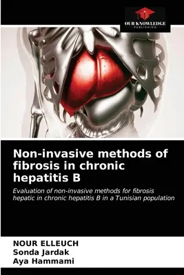 Neinvazívne metódy fibrózy pri chronickej hepatitíde B - Non-invasive methods of fibrosis in chronic hepatitis B