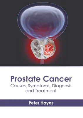 Rakovina prostaty: Príčiny, príznaky, diagnostika a liečba - Prostate Cancer: Causes, Symptoms, Diagnosis and Treatment