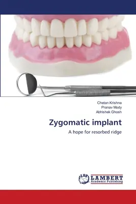 Zygomatický implantát - Zygomatic implant