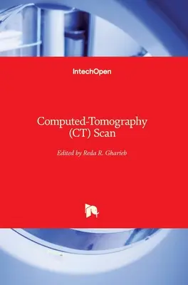 Počítačová tomografia (CT) - Computed-Tomography (CT) Scan
