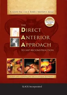 Priamy predný prístup k rekonštrukcii bedrového kĺbu - The Direct Anterior Approach to Hip Reconstruction