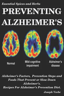 Prevencia Alzheimerovej choroby: Alzheimerova choroba: Faktory Alzheimerovej choroby, preventívne kroky a potraviny, ktoré zabraňujú Alzheimerovej chorobe alebo ju spomaľujú, recepty na prevenciu Alzheimerovej choroby D - Preventing Alzheimer's: Alzheimer's Factors, Prevention Steps and Foods That Prevent or Slow Alzheimer's, Recipes for Alzheimer's Prevention D